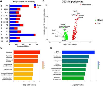 Preterm birth leads to a decreased number of differentiated podocytes and accelerated podocyte differentiation